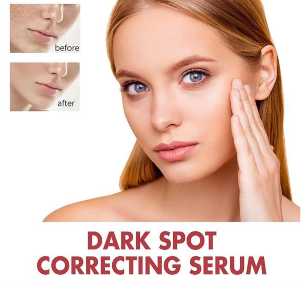DermaLuxe Niacinamide  10% Clarity Serum